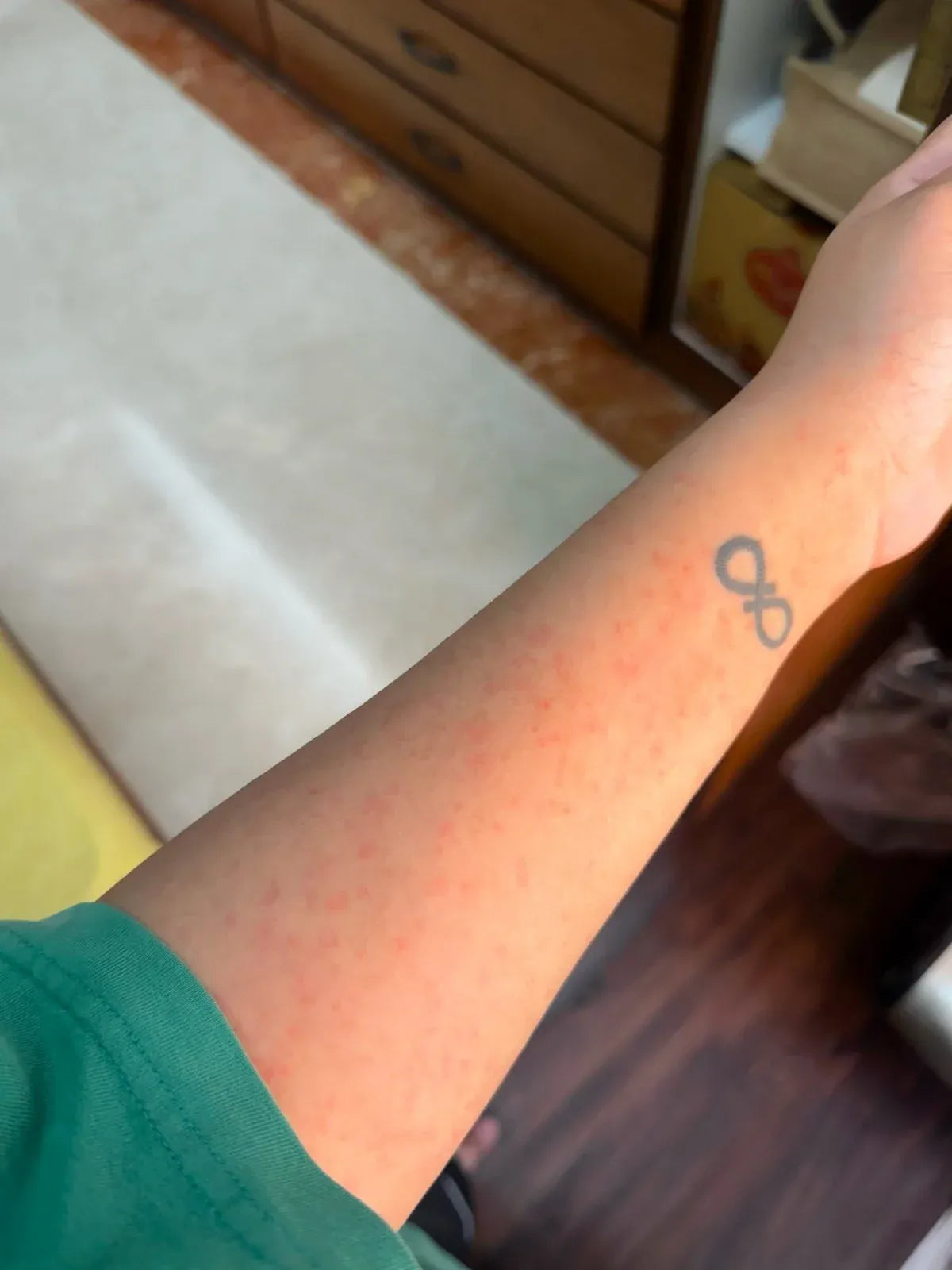 Aloe Vera Pulp Gel before 1