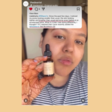 Sea Buckthorn Berry & Calendula Oil [Sensitive, Acne-Prone, Oily and Combination Skin]